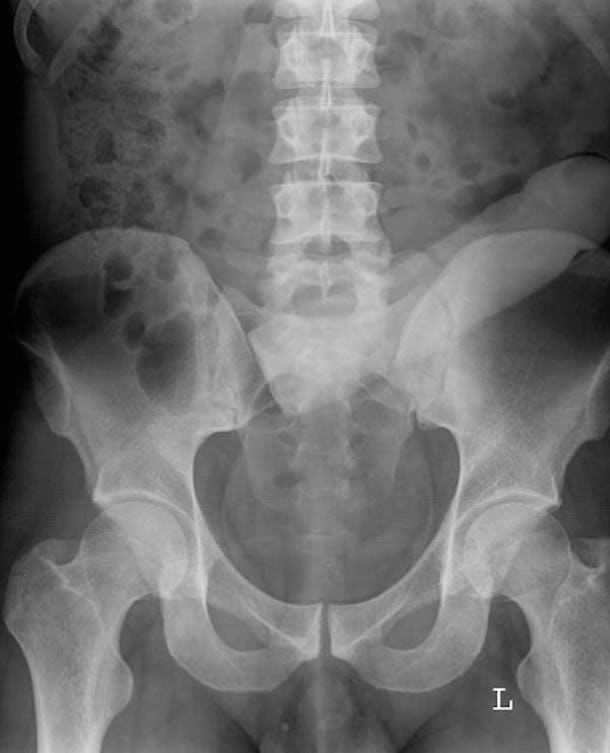 Website Compiles X Ray Photos Of Weird Things Stuck Up People S Butts