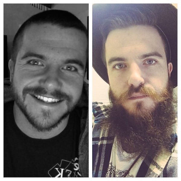 BeforeAndAfter Photos Prove Men Always Look Better With Beards