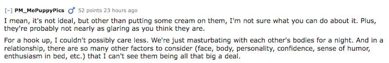 Guys Confess How They Really Feel About Your Flaws When You Re Naked