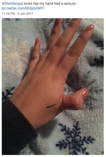 Scary Meme Claims To Show You How To Break Your Thumb