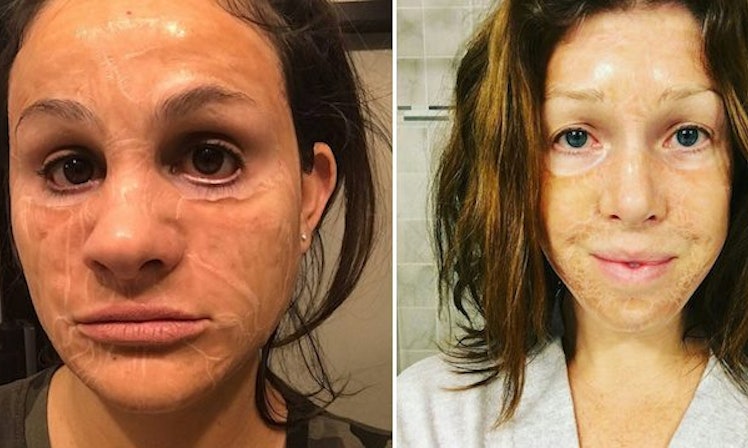 face slimming mask before and after 3 days