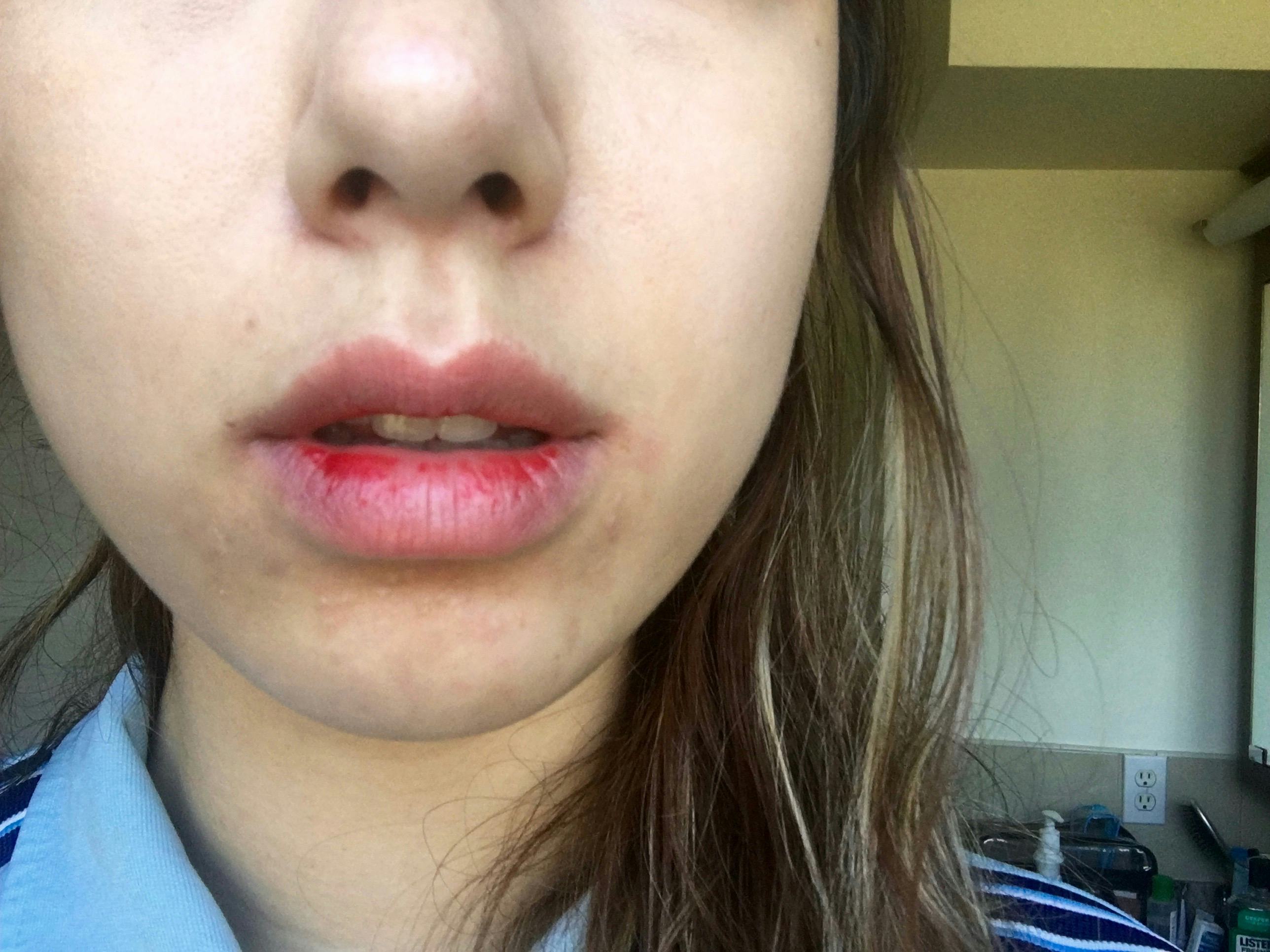 How to crimson off pull lips new photo How to crimson off pull lips best photo