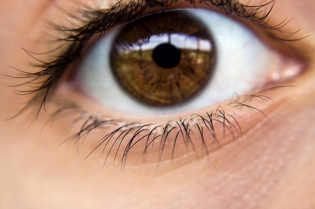 What Are The Skin Colored Bumps Under My Eyes? 5 Things You Didn't Know